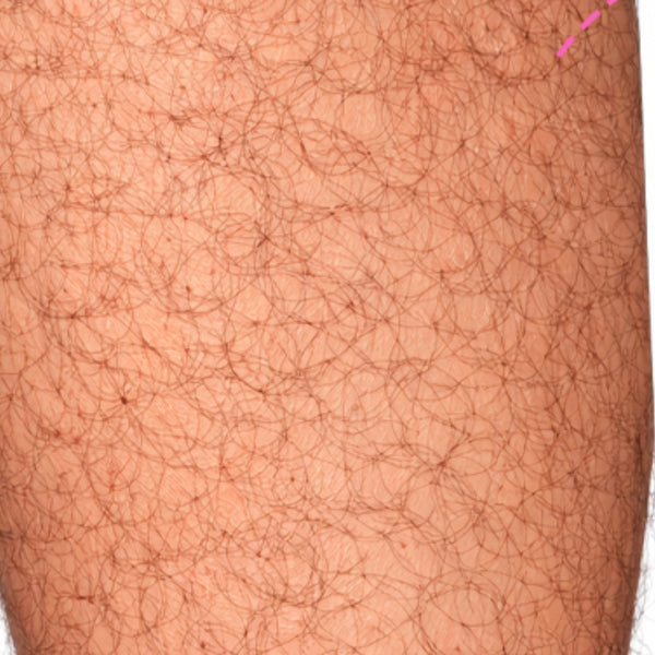 Before image