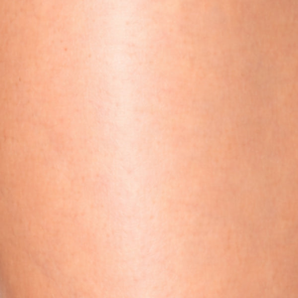After image