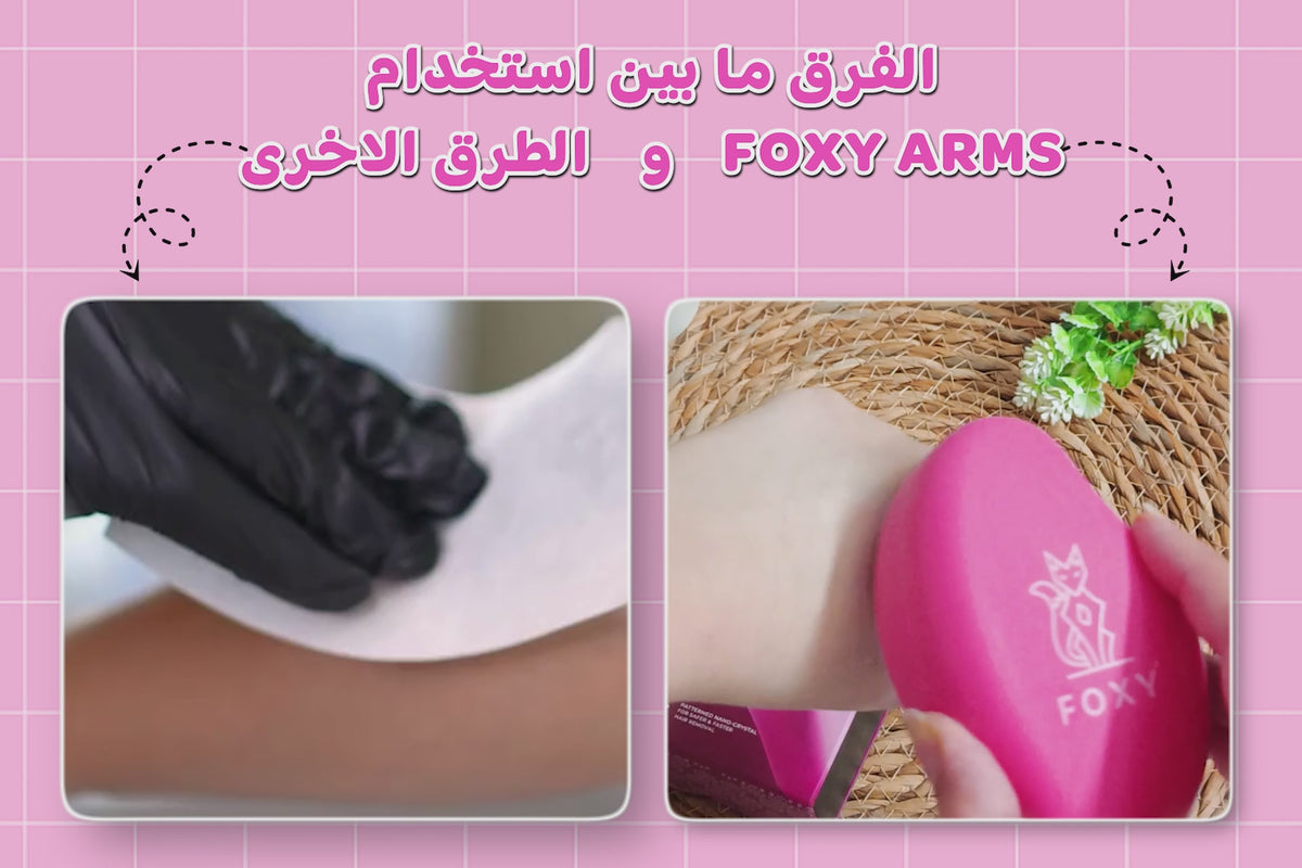 Arm